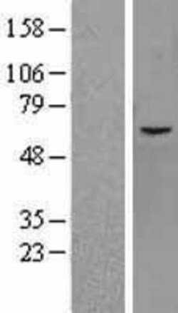 Novus Biologicals&trade;&nbsp;JMJD2D Overexpression Lysate