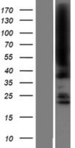 Novus Biologicals&trade;&nbsp;JMJD5 Overexpression Lysate