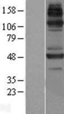 Novus Biologicals&trade;&nbsp;JMJD6/PSR Overexpression Lysate