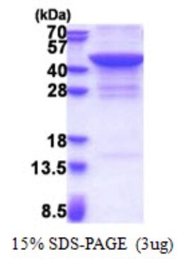 Novus Biologicals&trade;&nbsp;Recombinant Human JMJD7 His Protein