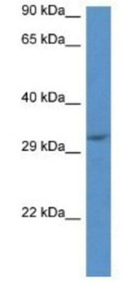 JMJD8 Antibody, Novus Biologicals:Antibodies:Primary Antibodies