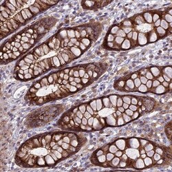 JMY Antibody, Novus Biologicals:Antibodies:Primary Antibodies