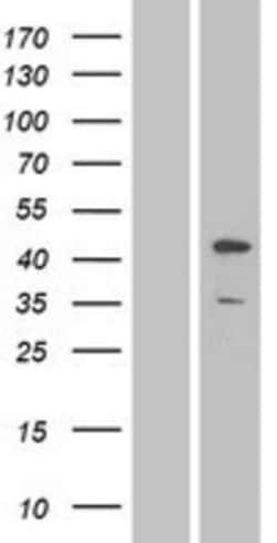 Novus Biologicals™ JNK1 Overexpression Lysate