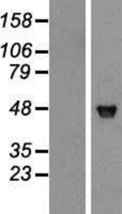 Novus Biologicals™ JNK1 Overexpression Lysate