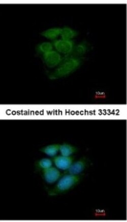 JNK2 Antibody, Novus Biologicals 0.1mL; Unlabeled:Antibodies, Polyclonal