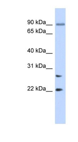 JOSD2 Antibody, Novus Biologicals:Antibodies:Primary Antibodies