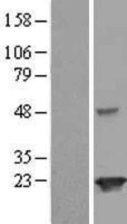 Novus Biologicals&trade;&nbsp;JOSD2 Overexpression Lysate