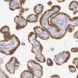 Josephin1 Antibody, Novus Biologicals:Antibodies:Primary Antibodies