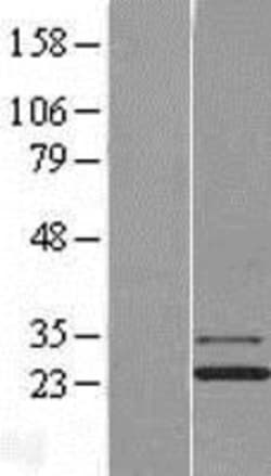 Novus Biologicals&trade;&nbsp;Josephin1 Overexpression Lysate