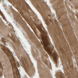 JPH1 Antibody, Novus Biologicals:Antibodies:Primary Antibodies
