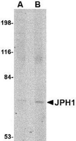 JPH1 Antibody - BSA Free, Novus Biologicals 0.1mg; Unlabeled:Antibodies,