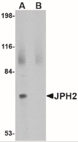 JPH4 Antibody - BSA Free, Novus Biologicals 0.025 mg, Unlabeled:Antibodies,