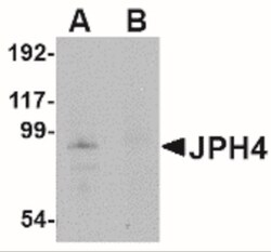 JPH4 Antibody - BSA Free, Novus Biologicals 0.1mg; Unlabeled:Antibodies,