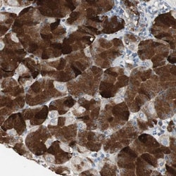 JTB Antibody, Novus Biologicals:Antibodies:Primary Antibodies