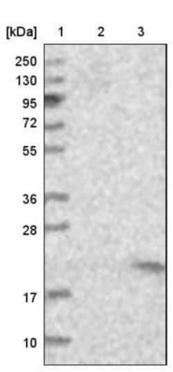 JTB Antibody, Novus Biologicals:Antibodies:Primary Antibodies