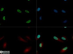 Jumonji/JARID2 Antibody, Novus Biologicals:Antibodies:Primary Antibodies