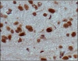 Jumonji/JARID2 Antibody, Novus Biologicals:Antibodies:Primary Antibodies