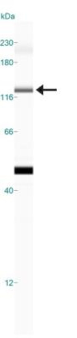 Jumonji/JARID2 Antibody, Novus Biologicals:Antibodies:Primary Antibodies