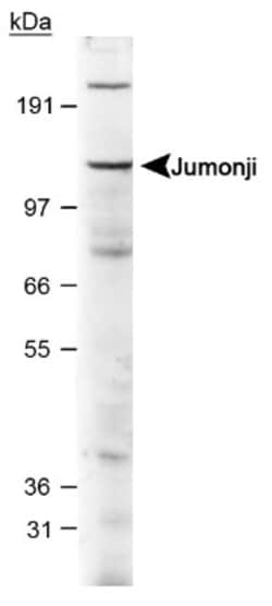 Jumonji/JARID2 Antibody, Novus Biologicals:Antibodies:Primary Antibodies