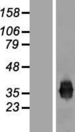 Novus Biologicals™ JAM-A Overexpression Lysate