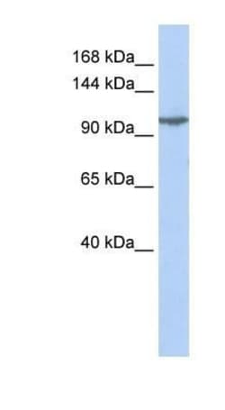 KA2/GRIK5/Glutamate Receptor KA2 Antibody, Novus Biologicals 100&mu;L;