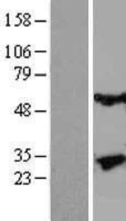 Novus Biologicals&trade;&nbsp;Kallikrein 13 Overexpression Lysate