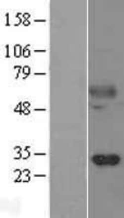Novus Biologicals&trade;&nbsp;Kallikrein 14 Overexpression Lysate