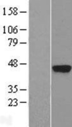 Novus Biologicals&trade;&nbsp;Kallikrein 5 Overexpression Lysate
