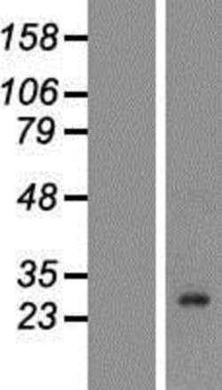 Novus Biologicals&trade;&nbsp;Kallikrein 7 Overexpression Lysate