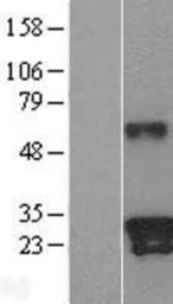 Novus Biologicals&trade;&nbsp;Kallikrein 9 Overexpression Lysate