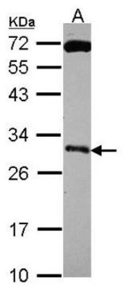 Kallikrein 10 Antibody, Novus Biologicals 0.1mL; Unlabeled:Antibodies,