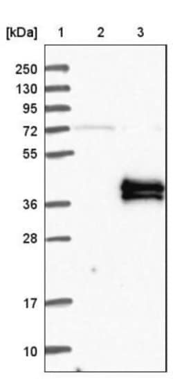 Kallikrein 15 Antibody, Novus Biologicals 0.1mL; Unlabeled:Antibodies,