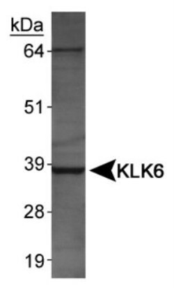 Kallikrein 6/Neurosin Antibody, Novus Biologicals 0.1mL; Unlabeled:Antibodies,