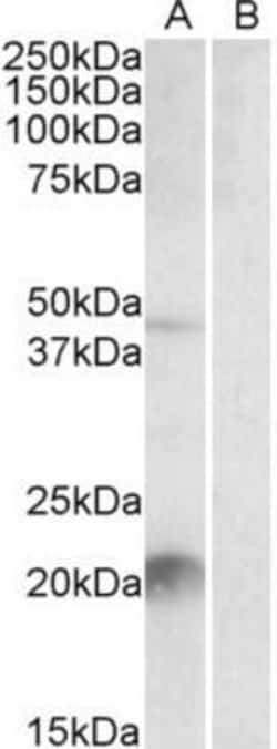Kallikrein 6/Neurosin Antibody, Novus Biologicals 0.1 mg | Buy Online | Novus Biologicals | Fisher Scientific