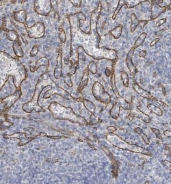 KANK3 Antibody, Novus Biologicals 0.1mL; Unlabeled:Antibodies, Polyclonal