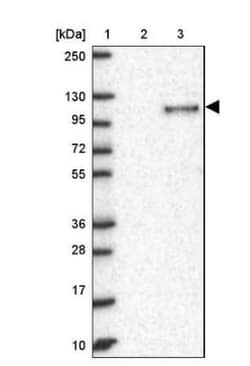 KANK3 Antibody, Novus Biologicals 0.1mL; Unlabeled:Antibodies, Polyclonal