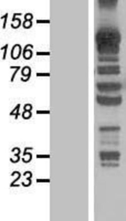 Novus Biologicals&trade;&nbsp;KANK4 Overexpression Lysate