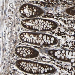 KANK4 Antibody, Novus Biologicals:Antibodies:Primary Antibodies