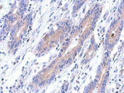 KANSL2 Antibody, Novus Biologicals 0.1mL; Unlabeled:Antibodies, Polyclonal