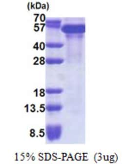 Novus Biologicals&trade;&nbsp;Recombinant Human KAP1 His Protein