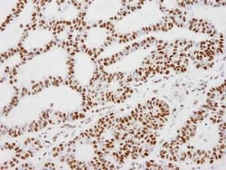 KAP1 Antibody, Novus Biologicals 0.1mL; Unlabeled:Antibodies, Polyclonal