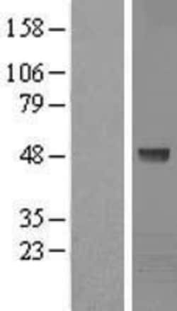 Novus Biologicals&trade;&nbsp;Kaptin Overexpression Lysate