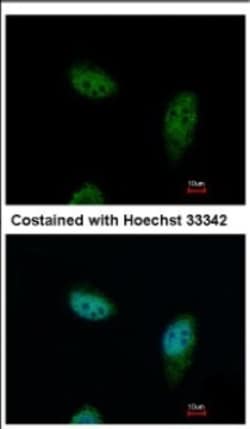 Karyopherin (importin) beta 3 Antibody, Novus Biologicals 0.1mL; Unlabeled:Antibodies,