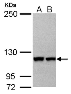 Karyopherin (importin) beta 3 Antibody, Novus Biologicals 0.1mL; Unlabeled:Antibodies,