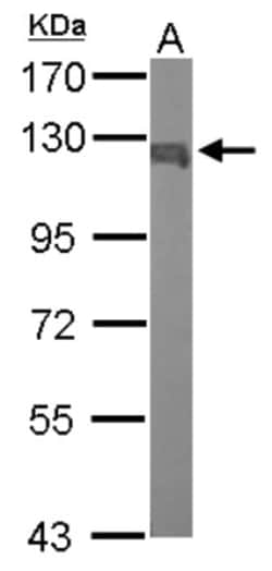 Karyopherin (importin) beta 3 Antibody, Novus Biologicals 0.1mL; Unlabeled:Antibodies,