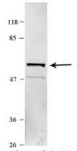 Karyopherin (importin) beta 3 Antibody, Novus Biologicals 100 &mu;L | Buy Online | Novus Biologicals | Fisher Scientific