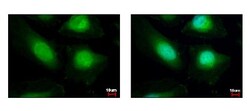 KAT1 Antibody, Novus Biologicals 0.1mL; Unlabeled:Antibodies, Polyclonal