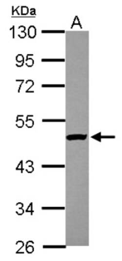 KAT1 Antibody, Novus Biologicals 0.1mL; Unlabeled:Antibodies, Polyclonal