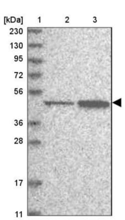 KAT1 Antibody, Novus Biologicals 25 &mu;L; Unlabeled:Antibodies, Polyclonal