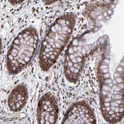 KAT3B/p300 Antibody, Novus Biologicals:Antibodies:Primary Antibodies